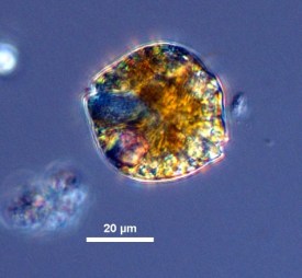 Photo of a single cell of the microscopic algae, Alexandrium catenella. It's rounded in shape, with varying colors of brown, yellow, and red within the cell. A scale bar of 20 micrometers indicates that the cell measures to be approximately 40 micrometers wide. The background is a dark blue color.